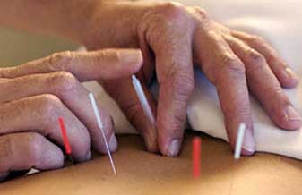 Clínica Monte Serrat - Foto 1